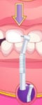 Play Bad Teeth Makeover Game